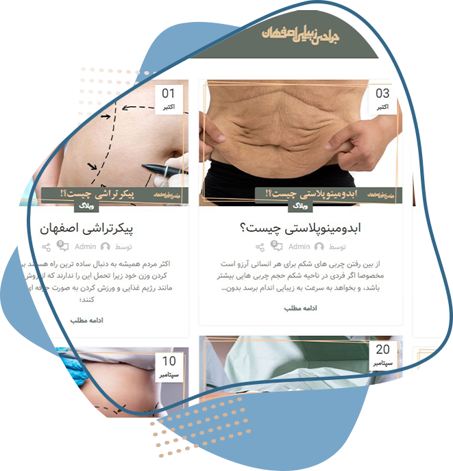 نمونه طراحی سایت پزشکی جراحی زیبایی اصفهان صفحه مقالات پزشکی توسط تفکر برتر